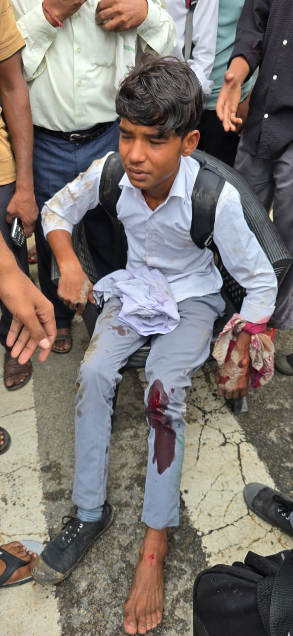 सिकंदराबाद: ऑटो ने बाइक सवार छात्रों को मारी टक्कर,तीन स्कूली छात्र घायल